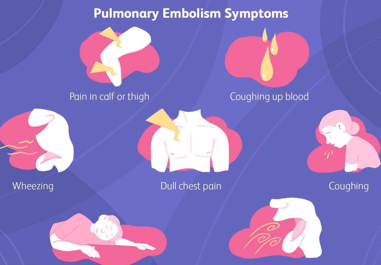 Áp dung những biện pháp cụ thể để ngăn ngừa Pulmonary Embolism