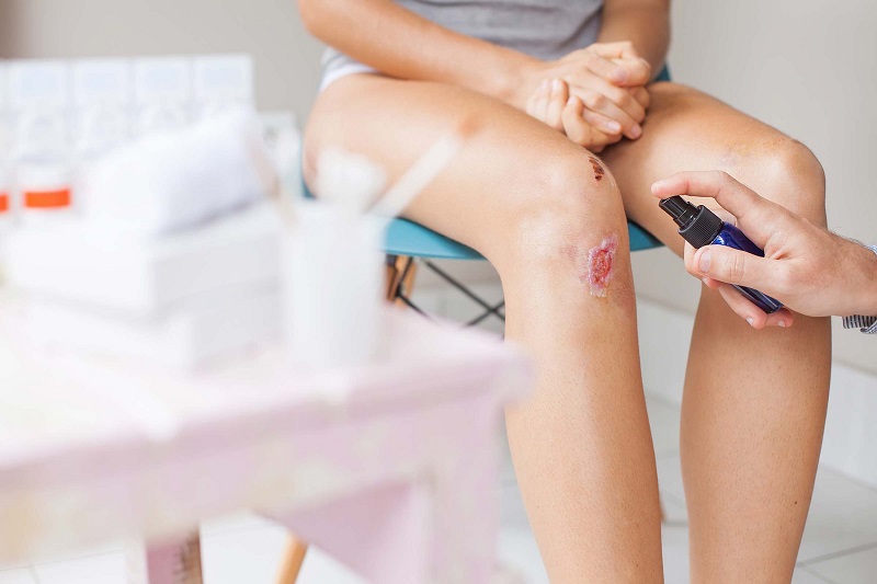 Vết thương đang trong giai đoạn lên da non cũng không được dùng oxy già
