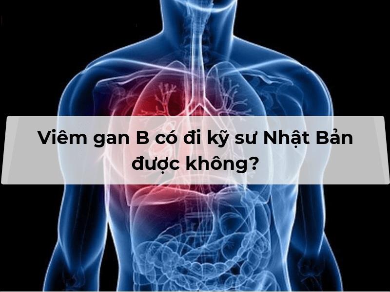 Trả lời câu hỏi viêm gan B có đi kỹ sư Nhật được không