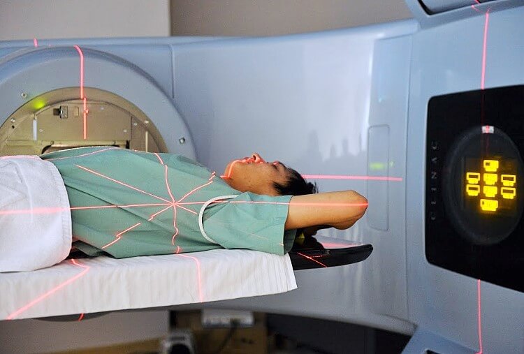 Xạ trị là như thế nào?