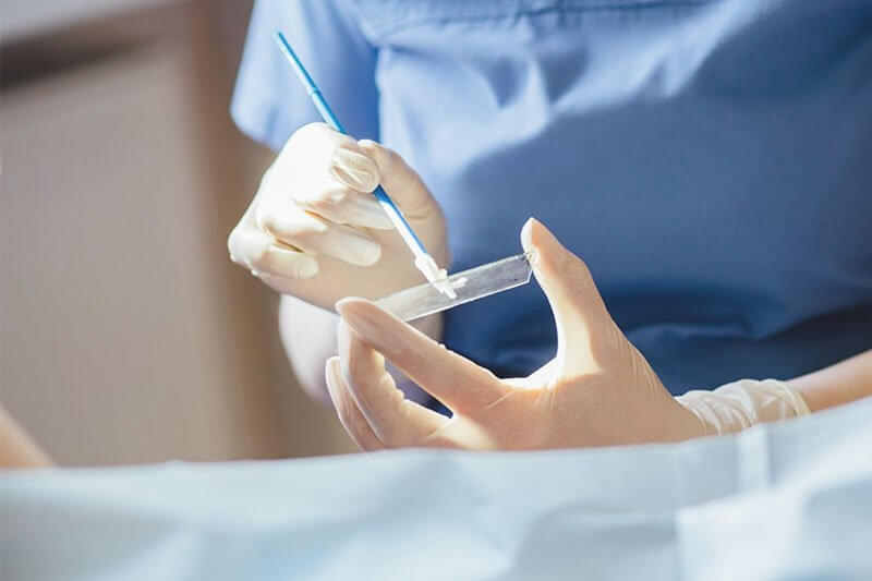 Xét nghiệm ANA không có ảnh hưởng gì đáng kể đến cơ thể bệnh nhân