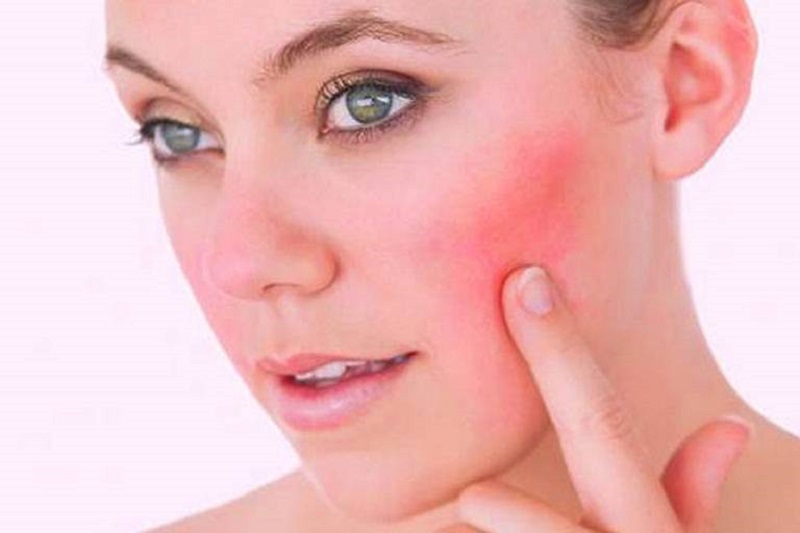 Làm xuất hiện nám và tàn nhang