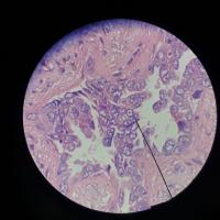 Bùi Thị Xuân Triều